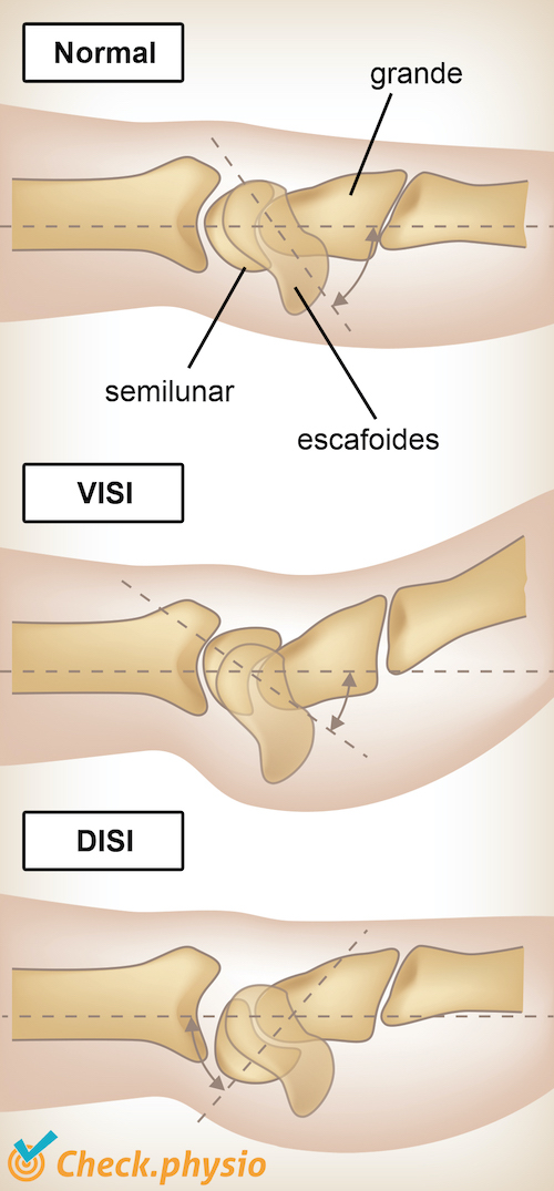 muñeca VISI DISI